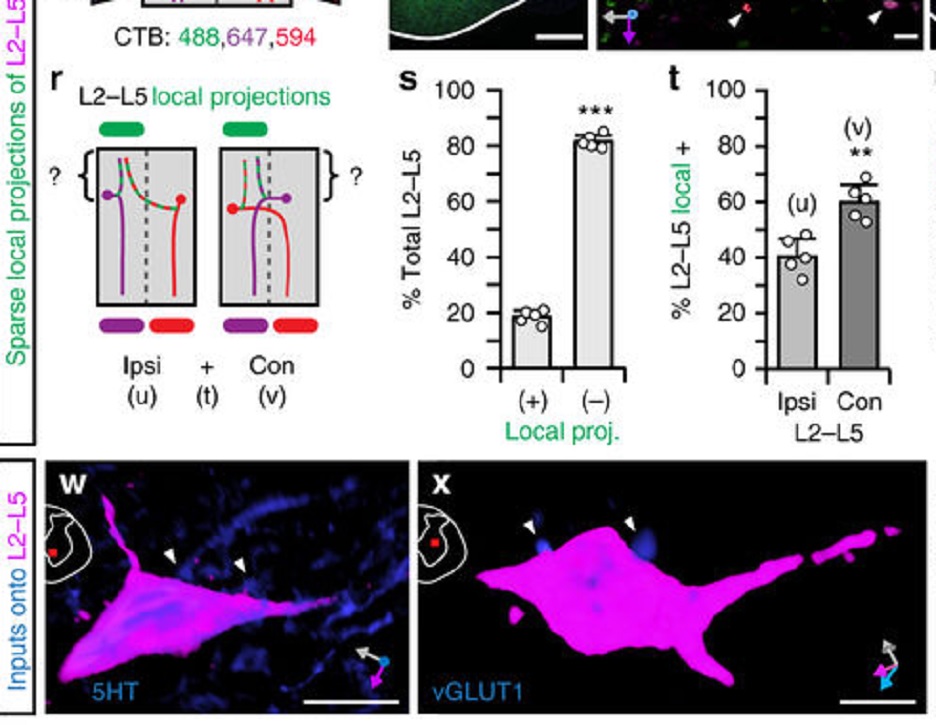 thermoscientific-amirasoftware_Reversible silencing of lumbar spinal interneurons