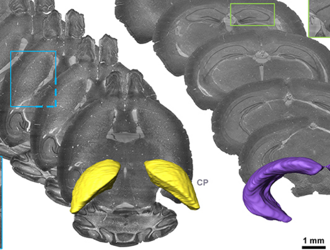 amira-software Precise Cerebral Vascular Atlas in Stereotaxic Coordinates of Whole Mouse Brain