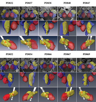 journal.pone.0201469.g007