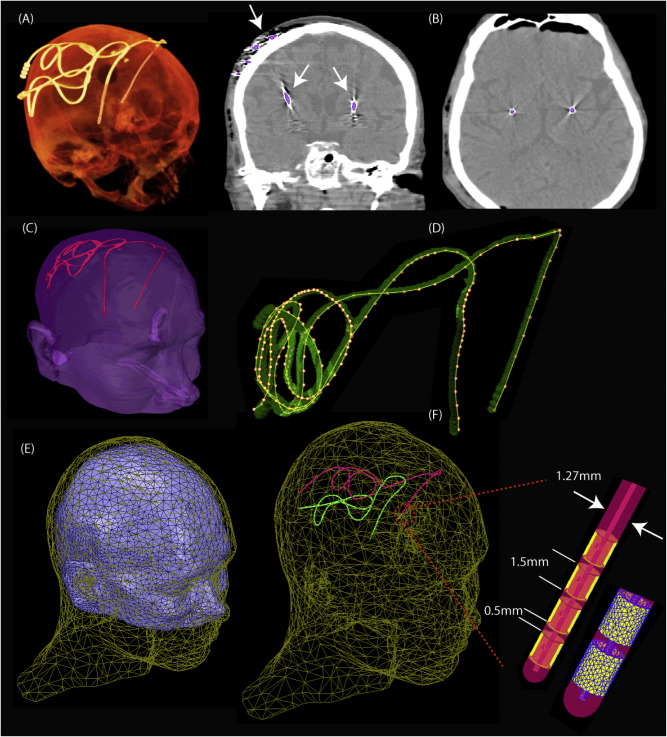 1-s2.0-S105381191830819X-gr2