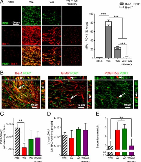 Hyperpolarized 13C MR metabolic imaging can detect neuroinflammation _amira-software