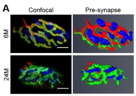Loss-of-adult-skeletal-muscle-stem-cells_amira-software