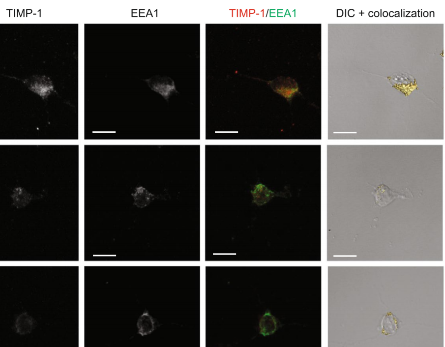 Intrinsic dynamics study identifies two_amira-software