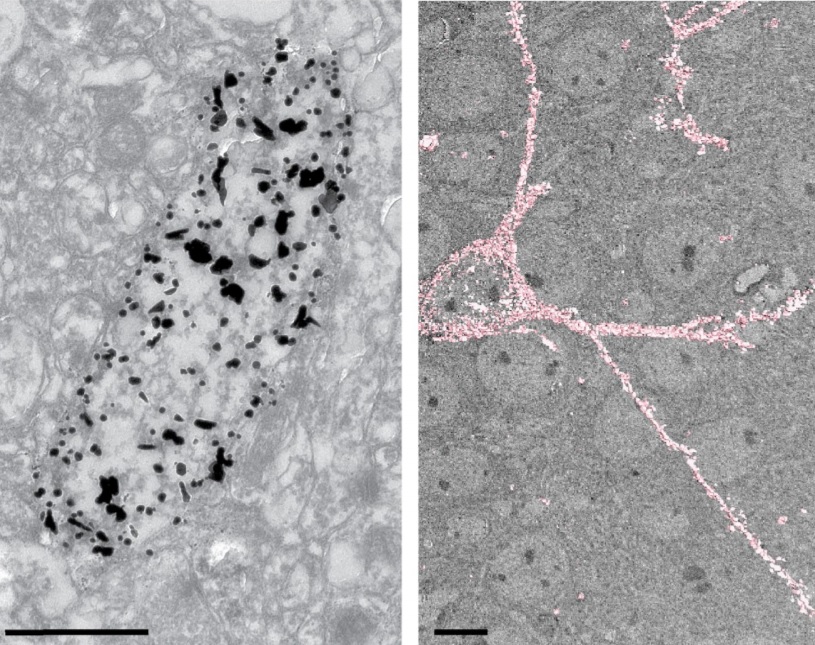 Modernization of Golgi staining