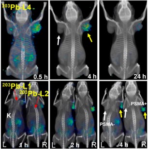 Compounds for Targeted Radiopharmaceutical Therapy of Prostate Cancer