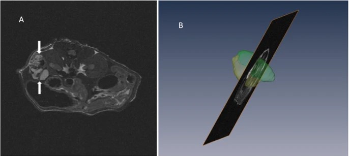 Ultrasound Molecular Imaging of Renal Cell Carcinoma