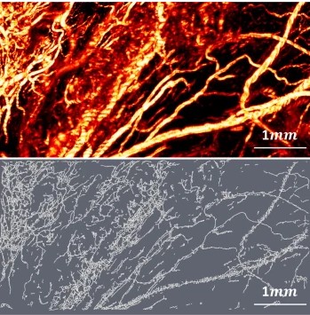 skeletonized vasculature ovary and fallopian tube
