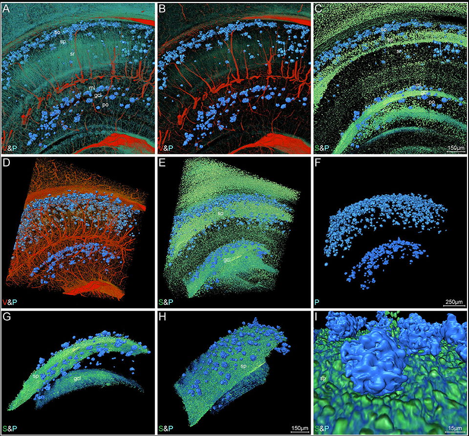Visual reconstruction of Aβ plaques and adjacent somata and vessels in hippocampal area