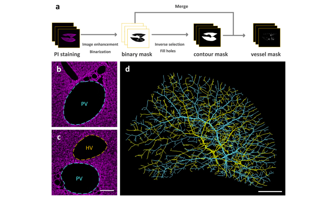 Multiscale reconstruction of various vessels in the